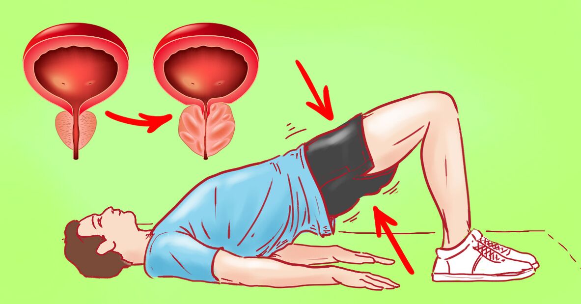 Therapeutic exercises for chronic prostate